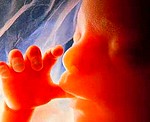 Hiszpańscy lekarze protestują przeciwko aborcyjnym planom Zapatero.